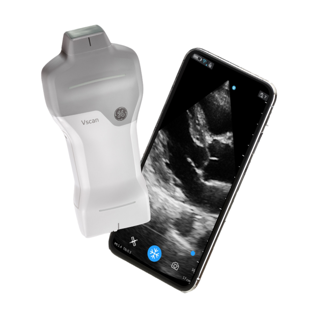 Mobile Ultraschallgeräte