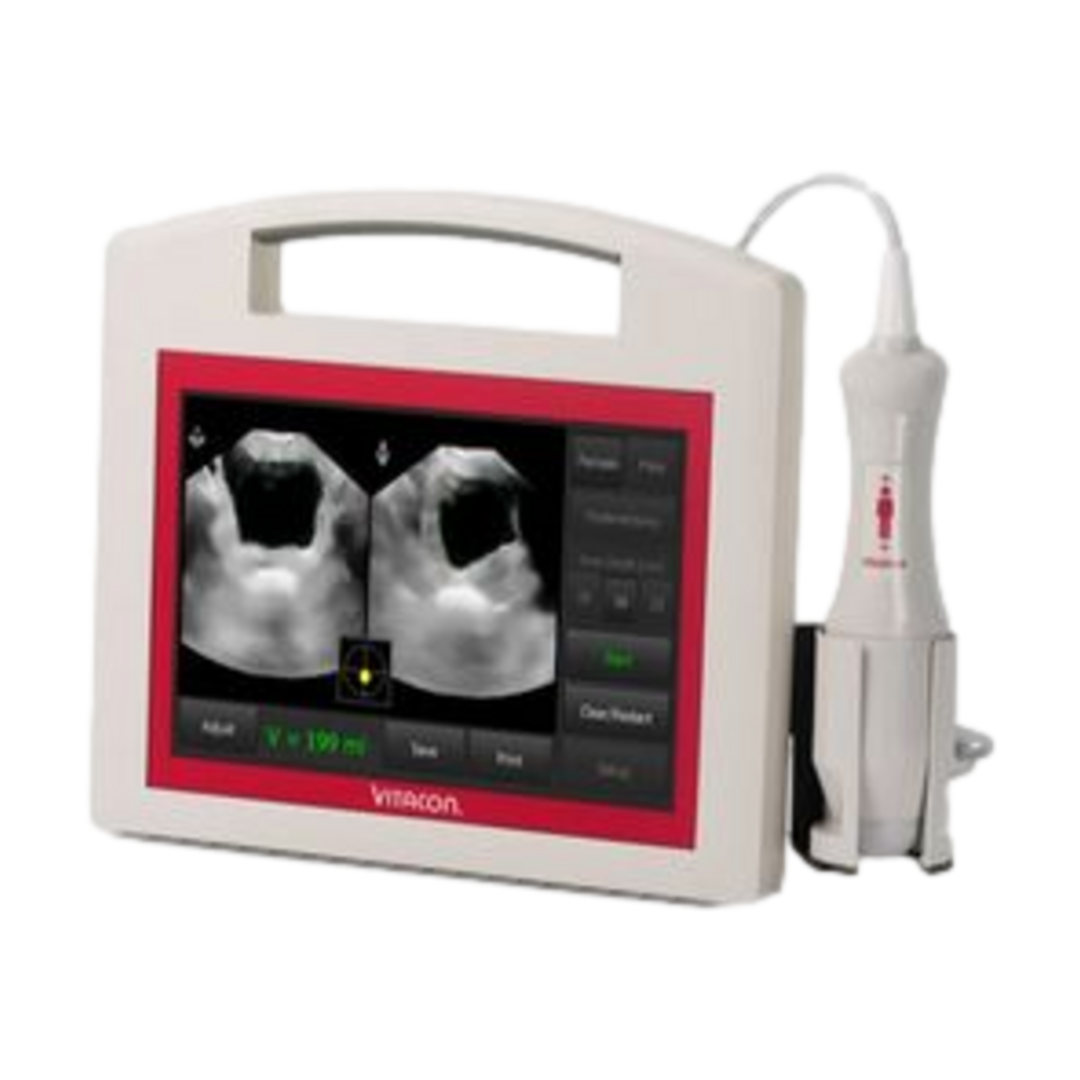 Vitascan PD v2 Bladder Scanner