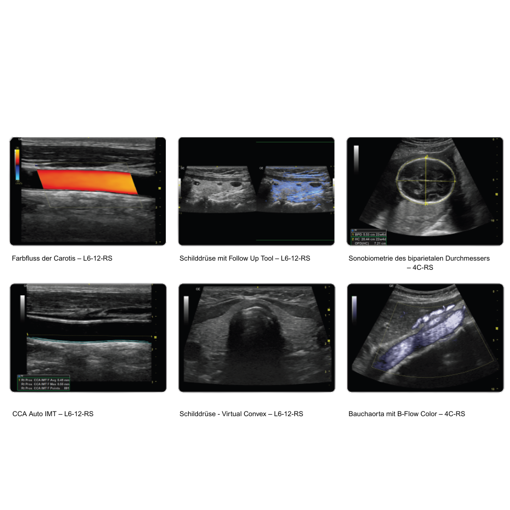 GE Versana Essential - Berger Medizintechnik GmbH