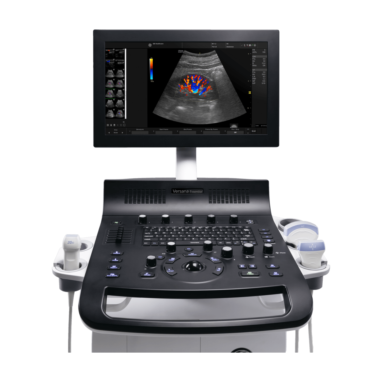 GE Versana Essential
