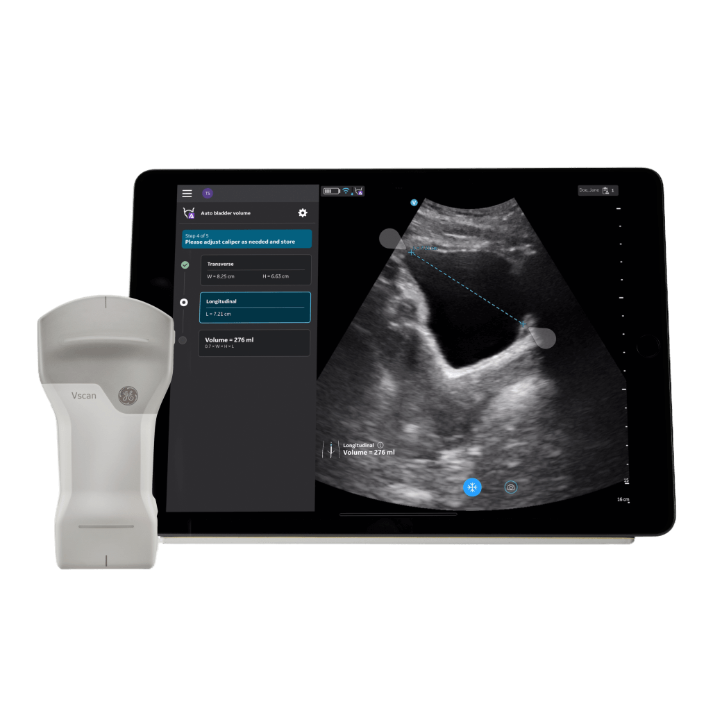 Vscan Air CL mit Tablet, Messung des Blasenvolumens mit Auto Bladder Volume