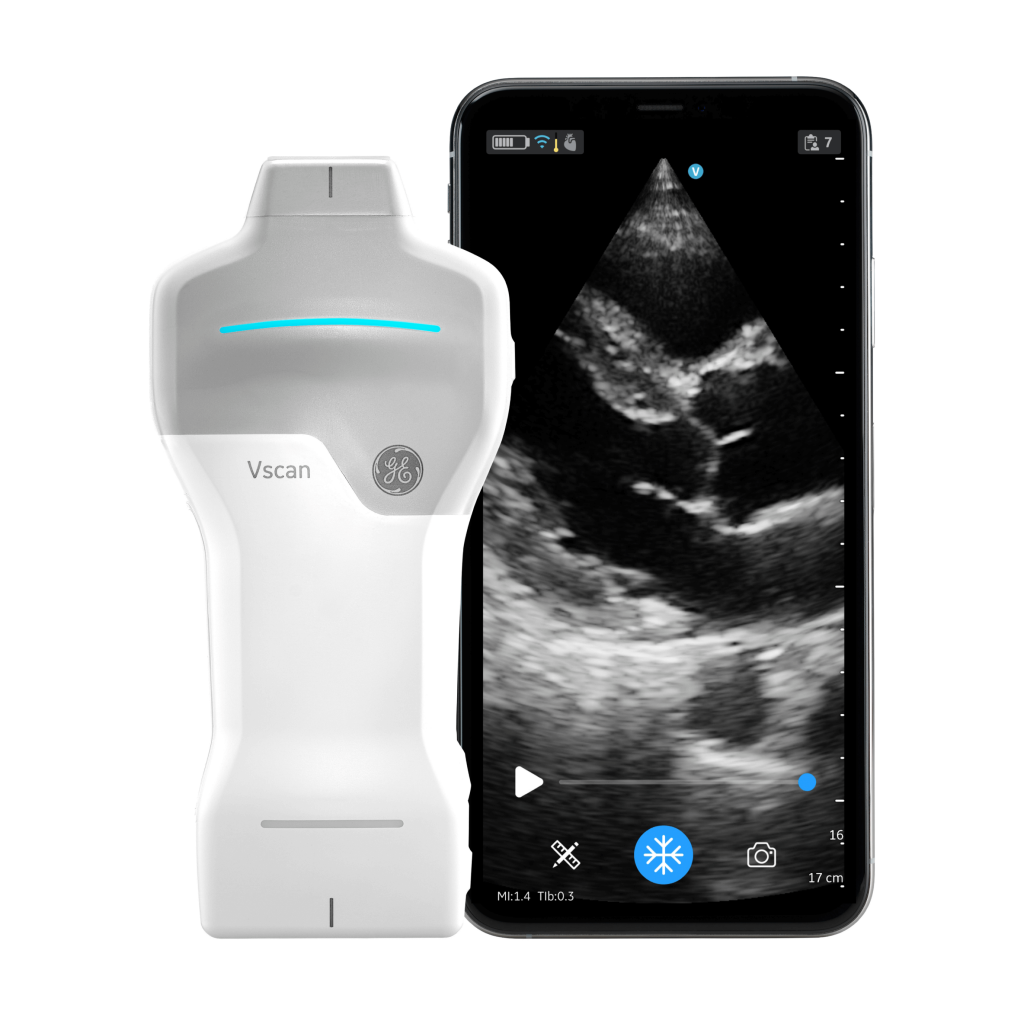 Vscan Air SL Sonde mit Smartphone, Herz im parasternalen Längsschnitt