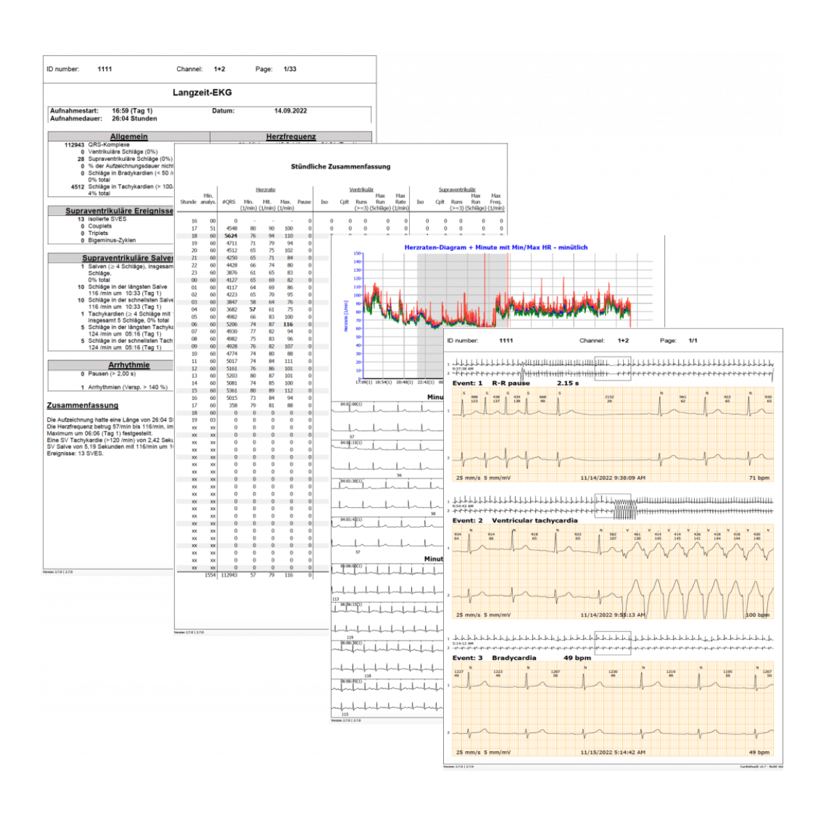 HeartX® Holter - Auswerteservice LZ EKG - Berger Medizintechnik GmbH