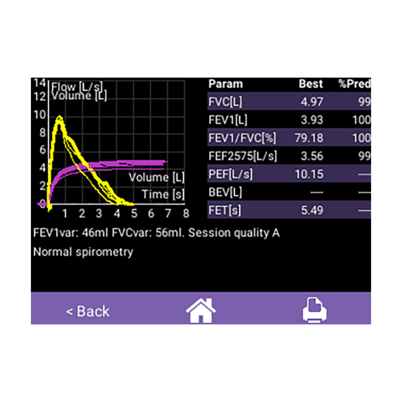 EasyOne® Air - Spirometer