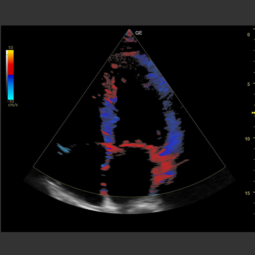 GE Ultraschall Versana Balance - Berger Medizintechnik GmbH