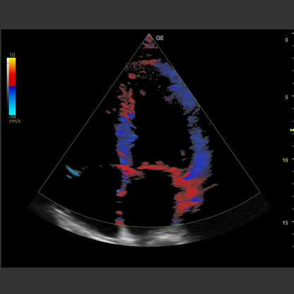 GE Ultraschall Versana Balance - Berger Medizintechnik GmbH