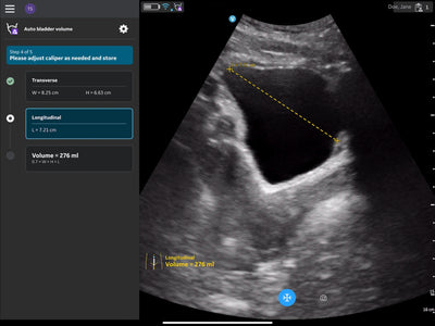 Atualização Auto-Bladder-Volume - Berger Medizintechnik GmbH