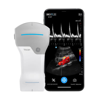 Vscan Air CL mit Smartphone, Aorta im Farbdoppler mit PW-Doppler-Spektrum