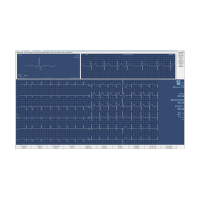 CardioSoft V7 'light' - Berger Medizintechnik GmbH